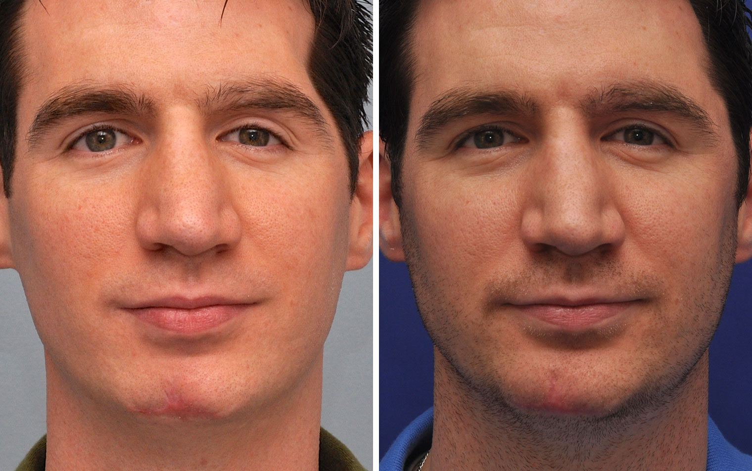 Austin facial plastic surgery